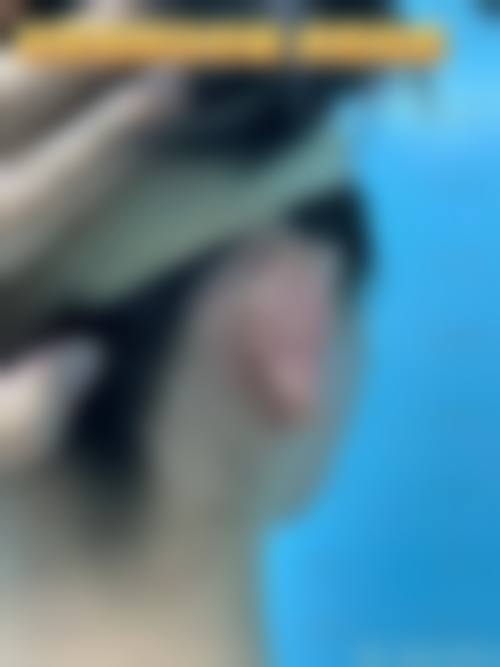 北京小美微针整形医院特色诊疗项目与技术优势