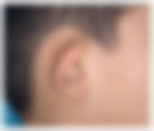 黄运严医生技术优势