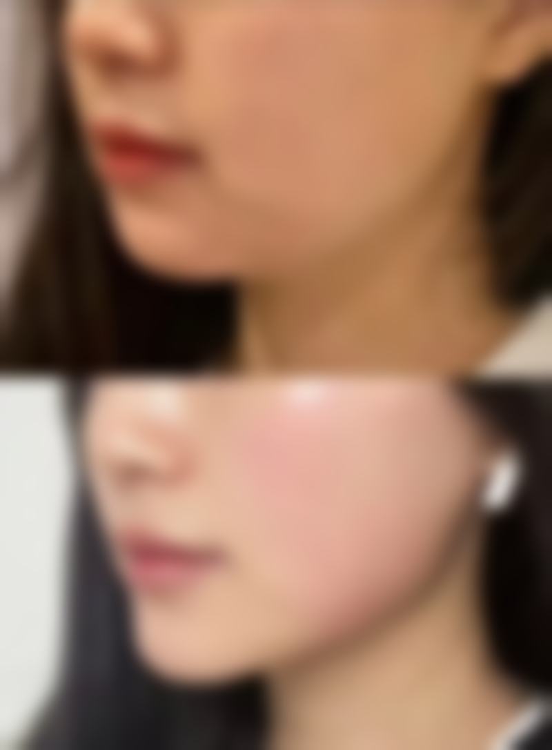 何燕医生技术优势