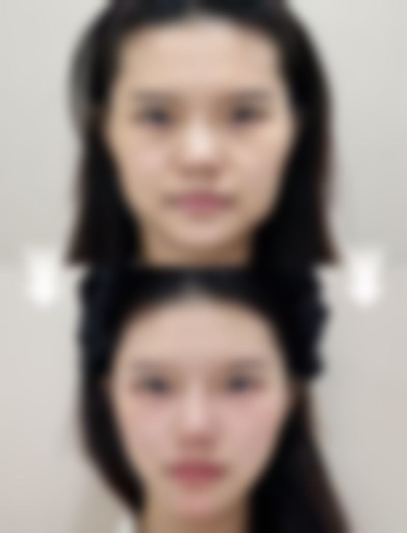 长春汇美医疗美容门诊部预约挂号方式