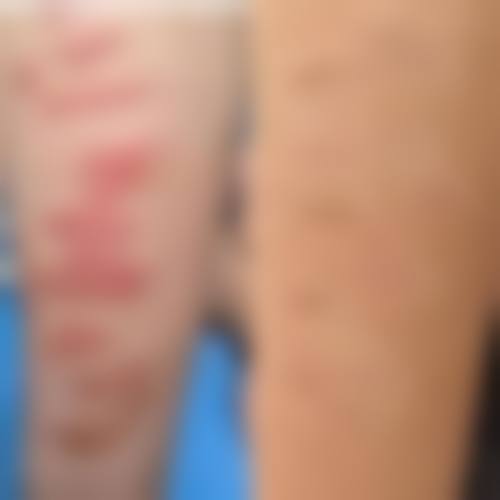 苏静莉医生预约挂号