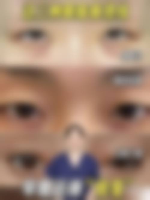 付炳根医生项目收费价格