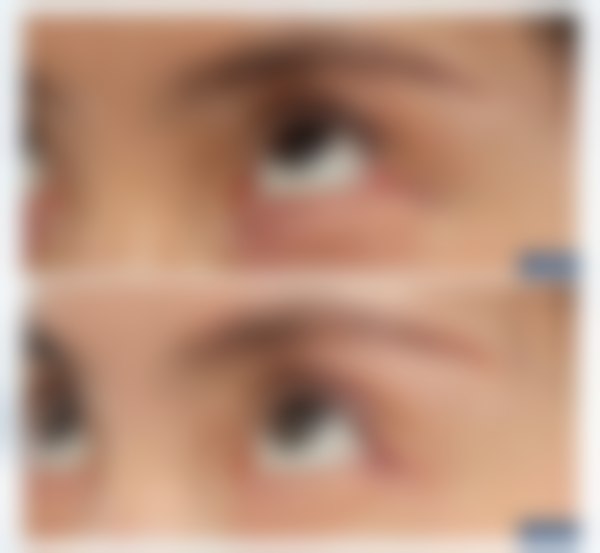 杜园园医生项目收费价格