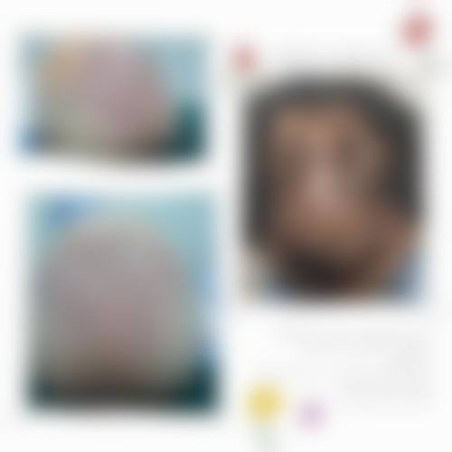 俪人连天美植发整形美容医院收费价格表