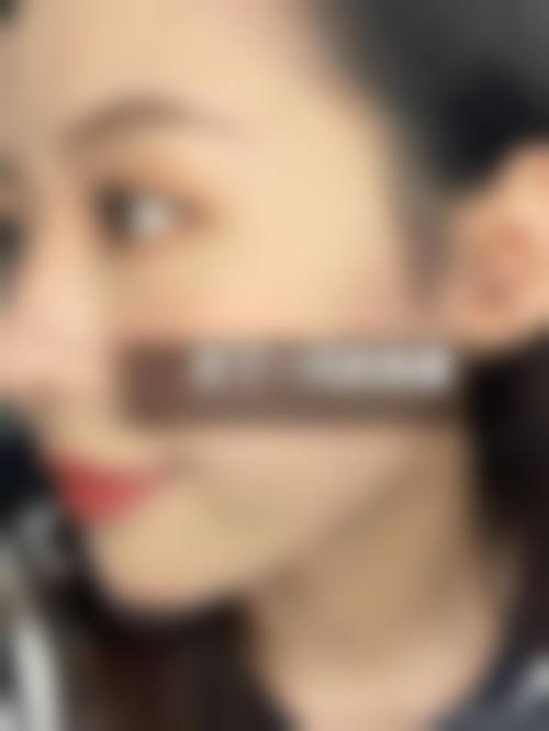 王伟民医生技术优势