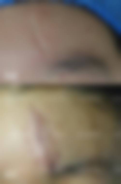 全薛蓉医生预约挂号