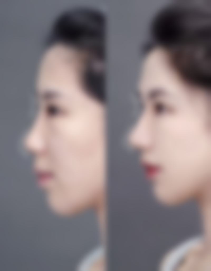 泰国LBC Clinic美容整形医院特色诊疗项目与技术优势