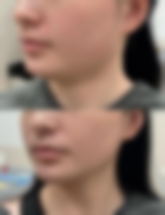 宋帅医生项目收费价格