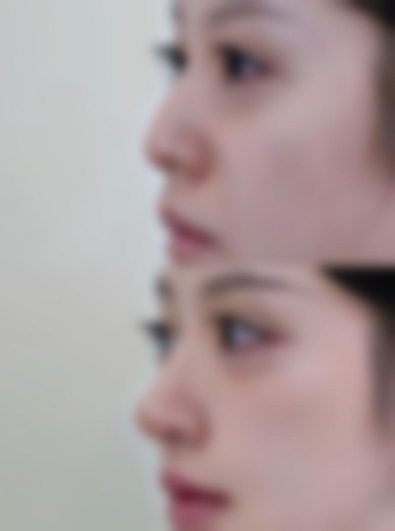 范建辉医生项目收费价格