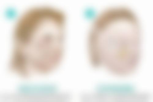 于秀英医生技术优势