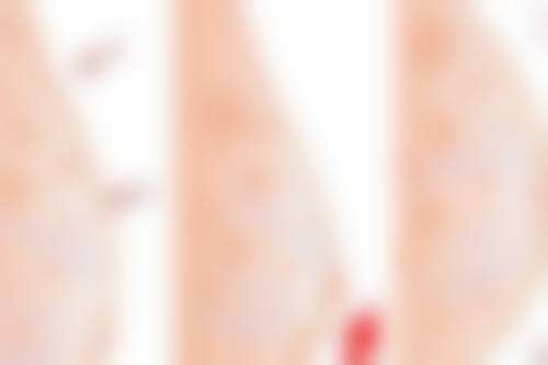 日本乳房再建整形医院预约挂号方式