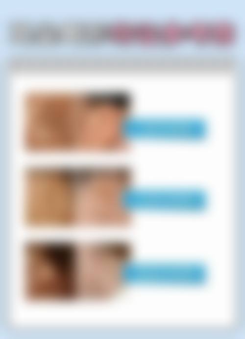 北京西美医疗美容医院预约挂号方式