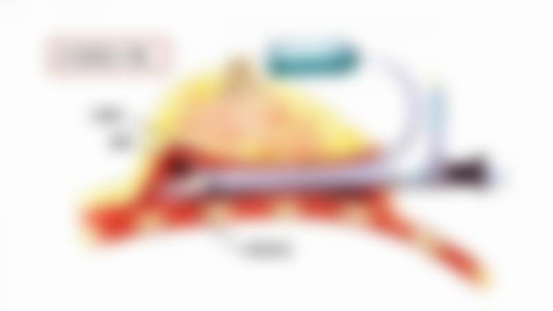 何贤清医生项目收费价格