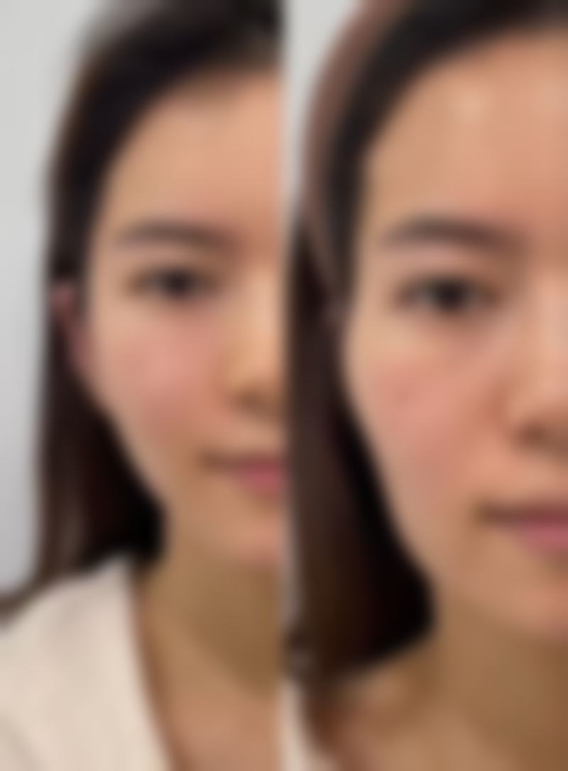 袁世伟医生项目收费价格