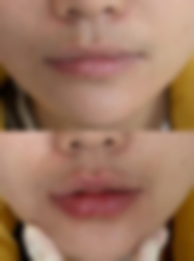 博多痤疮诊所预约挂号方式