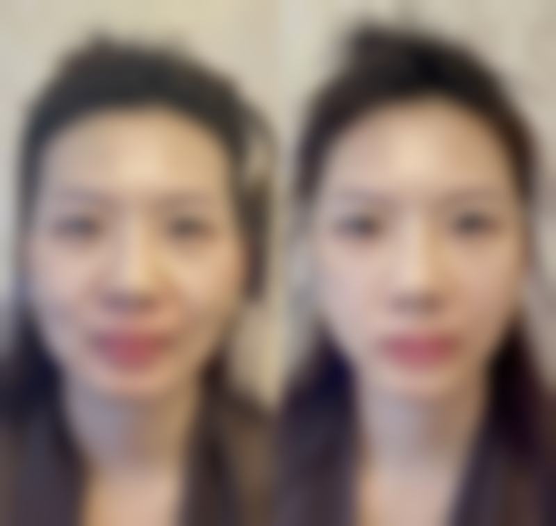 久匠纹眉国内连锁（厦门旗舰店）收费价格表