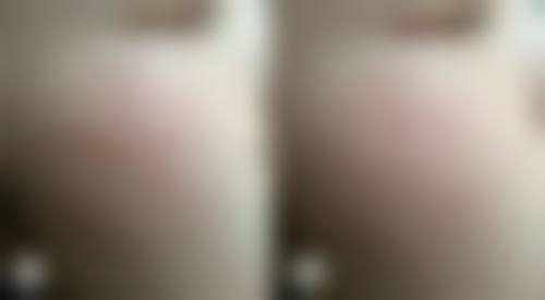 杨柏军 医生口碑评价及反馈内容