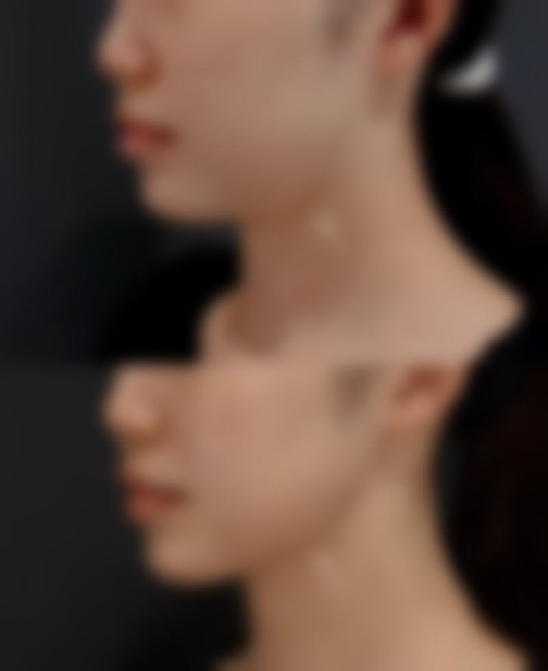 杨柏军 医生项目收费价格