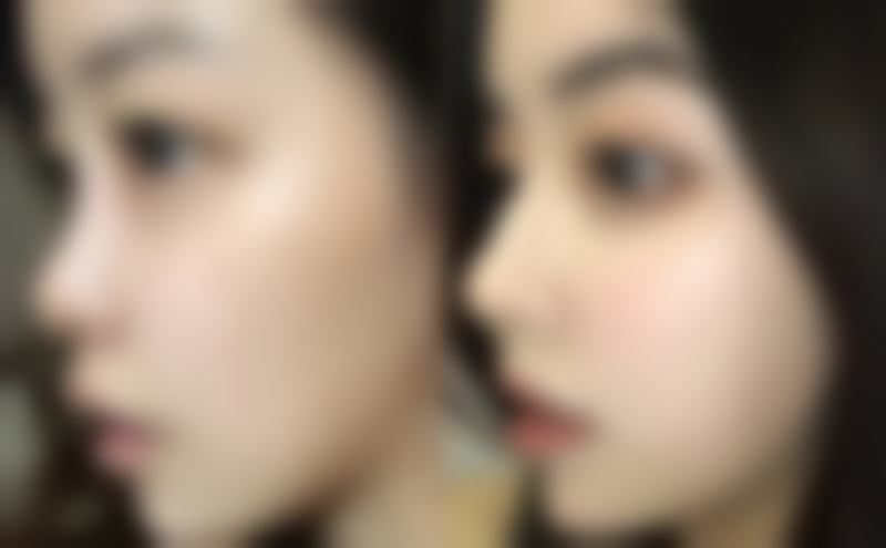 叶家静医生技术优势