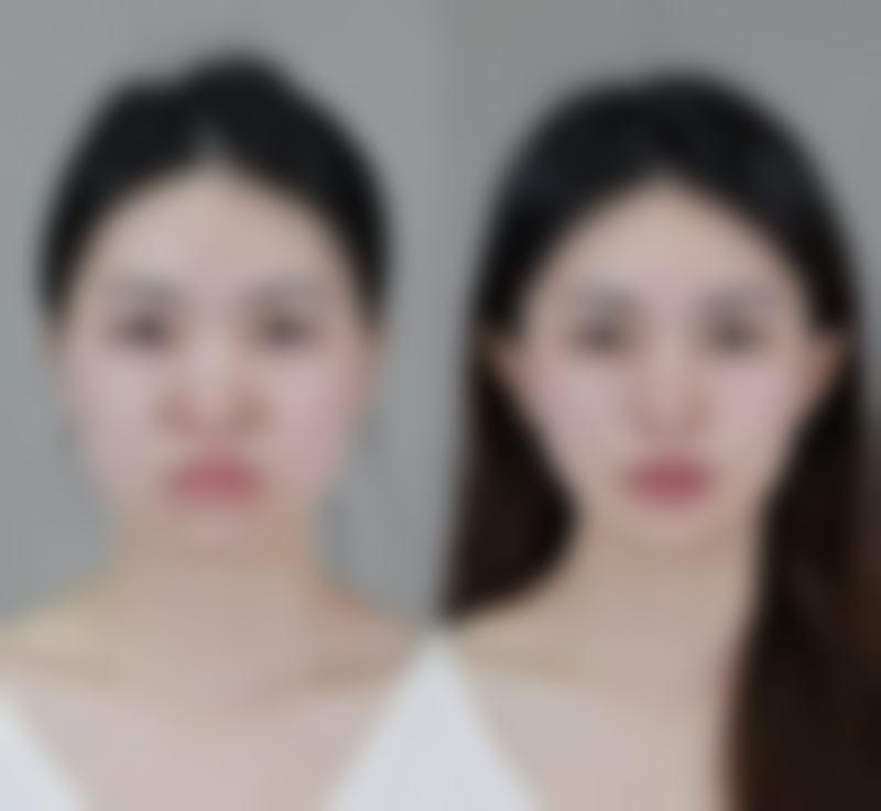 承德名媛医疗美容医院收费价格表