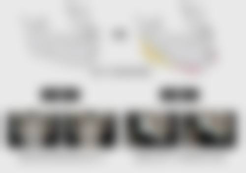 张恩祥医生技术优势