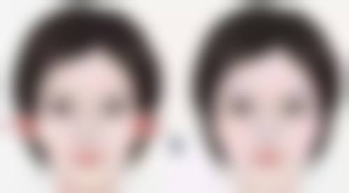 张恩祥医生项目收费价格