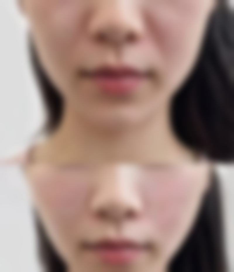 李祖培医生技术优势