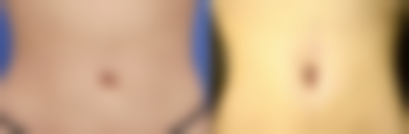 李祖培医生执医荣誉