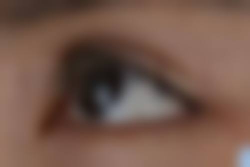 张赛赛医生技术优势