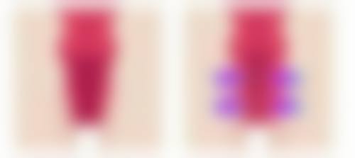 李绿水医生技术优势