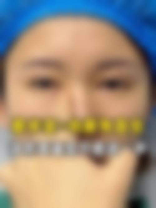 史增勇医生项目收费价格