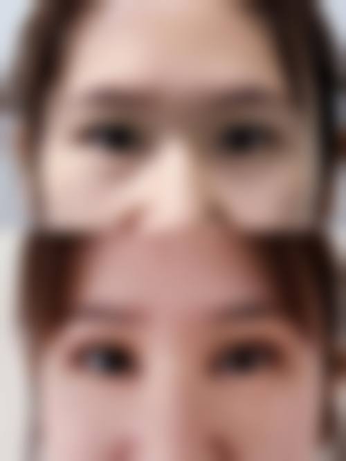 史增勇医生技术优势