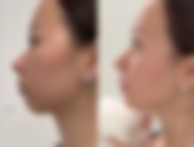 张赛赛医生预约挂号