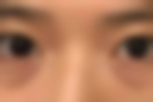 胡建武医生技术优势