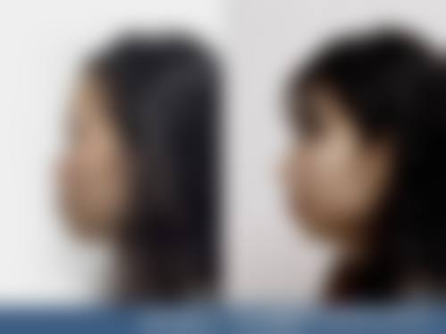 覃秋海医生预约挂号