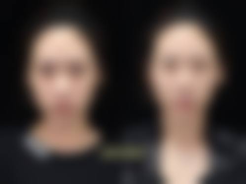 云南华美美莱整形美容医院收费价格表