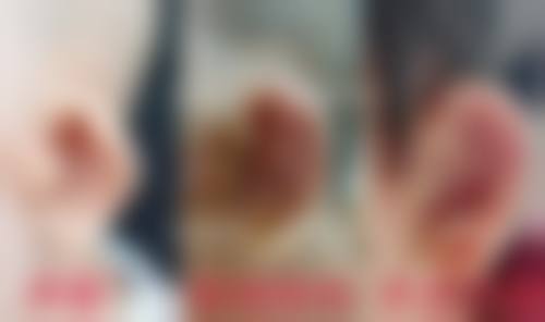 林琳医生项目收费价格