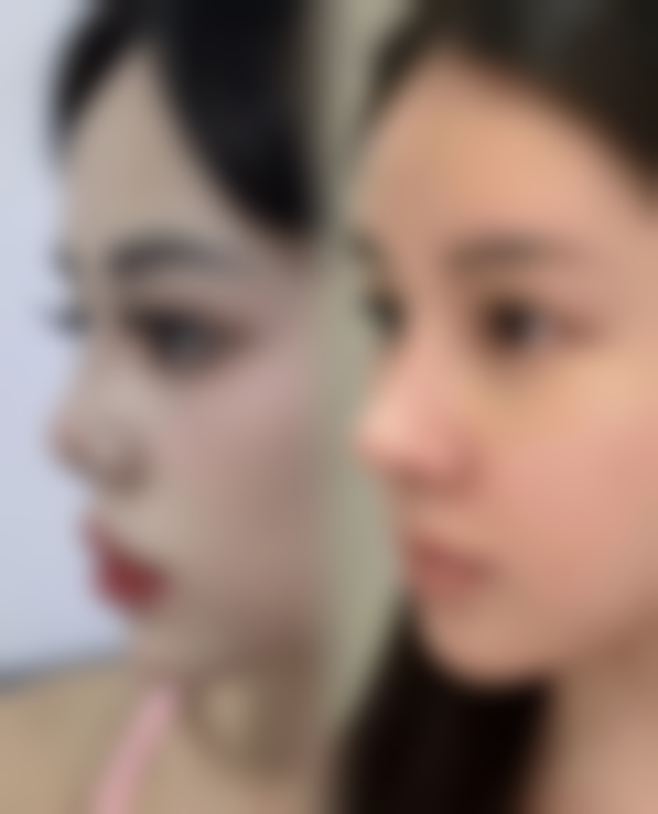 福建武警总队医院激光整形美容中 心特色诊疗项目与技术优势