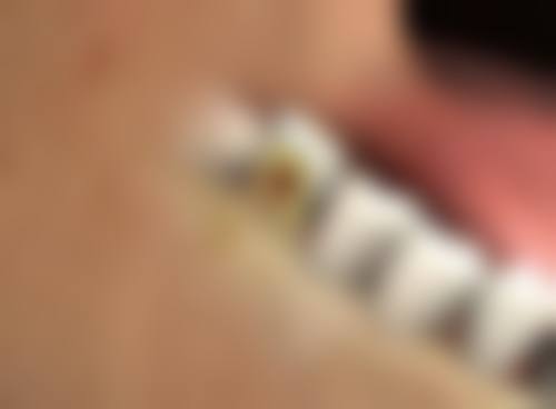 钟小媛医生技术优势