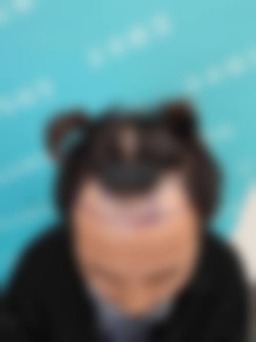 武汉武总植发专科医院预约挂号方式