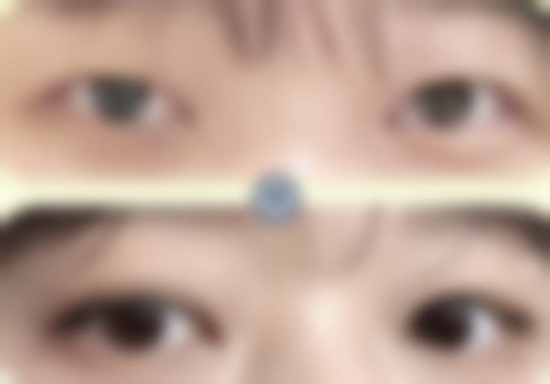 资阳市第一人民医院烧伤整形科收费价格表