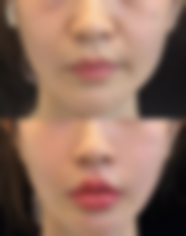 钟小媛医生预约挂号