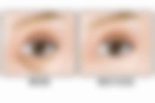 王占良医生项目收费价格