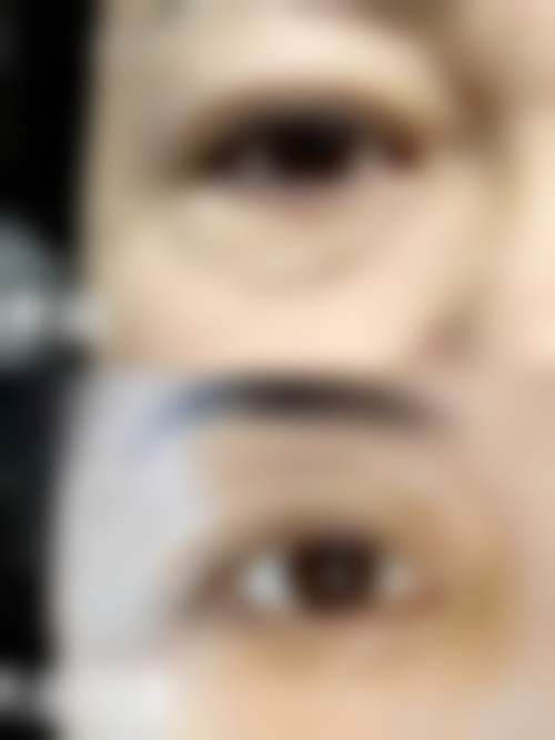 达州璞龄整形医院收费价格表