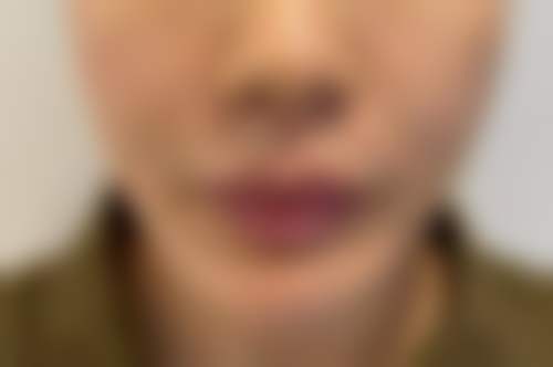 南平时光整形美容医院预约挂号方式