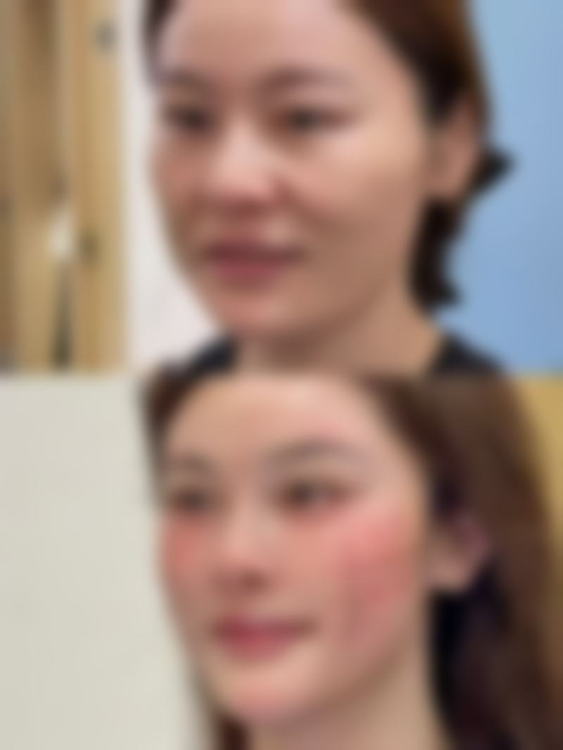 梁胜文医生技术优势