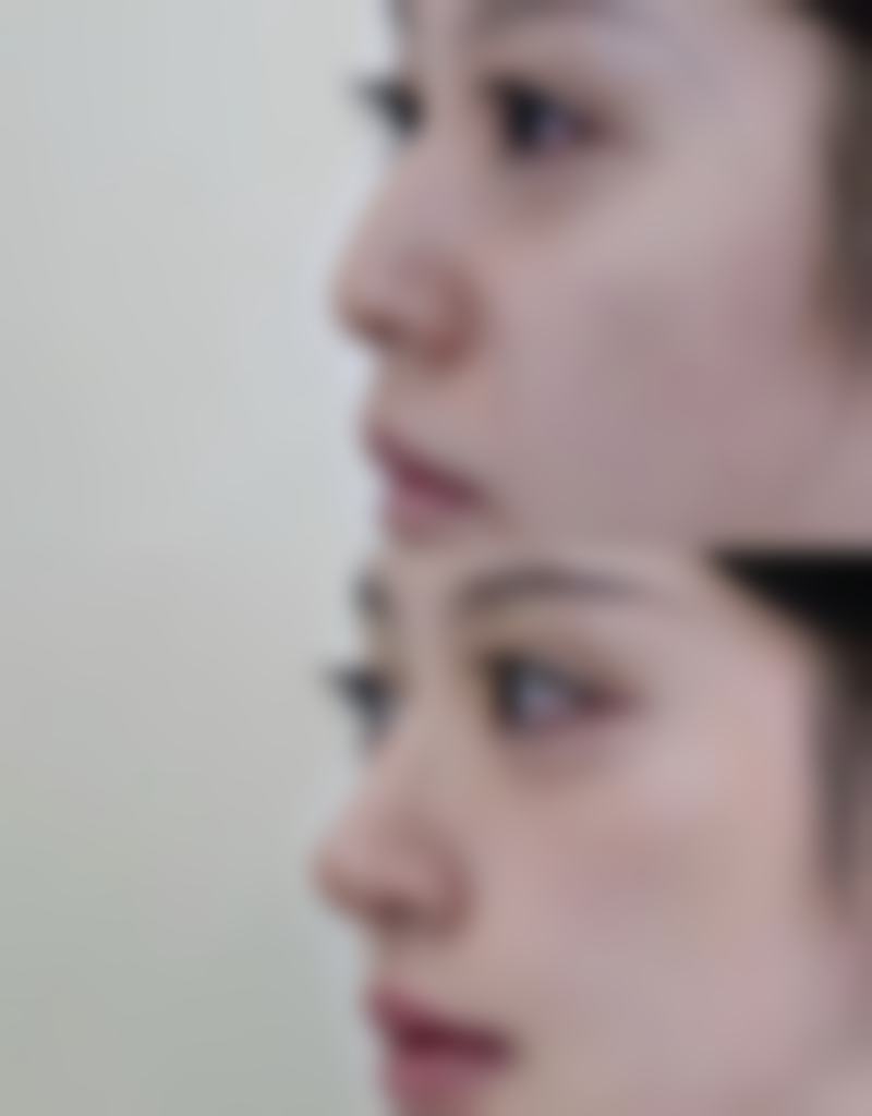 枣庄友谊医院丽华整形中 心收费价格表