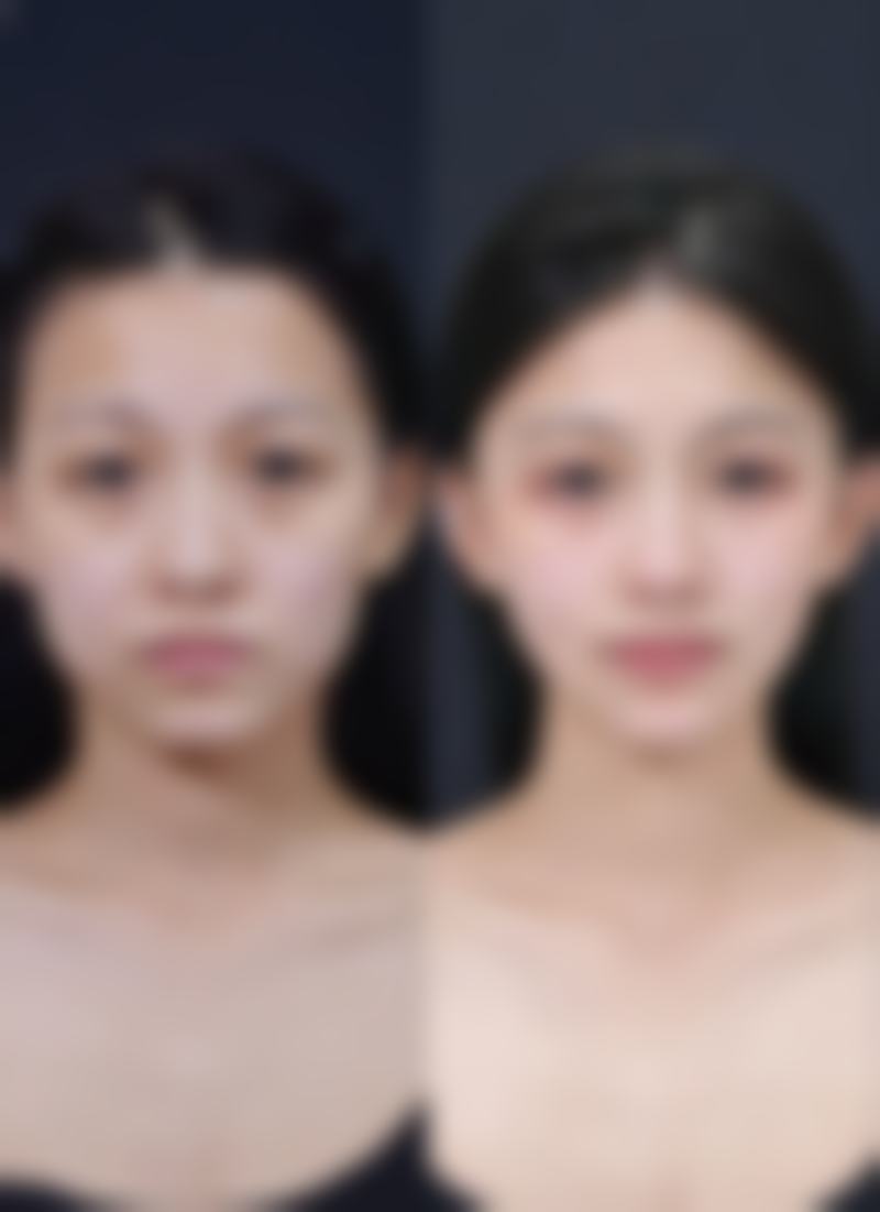 商丘梁园韩艺医疗美容收费价格表
