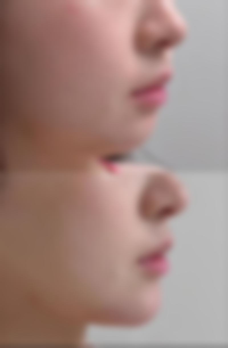 房玉宝医生技术优势