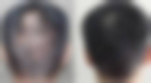 长春绽放江依南医疗美容诊所收费价格表